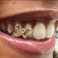 Gold grillz