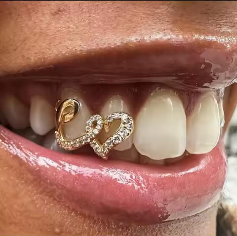 Gold grillz