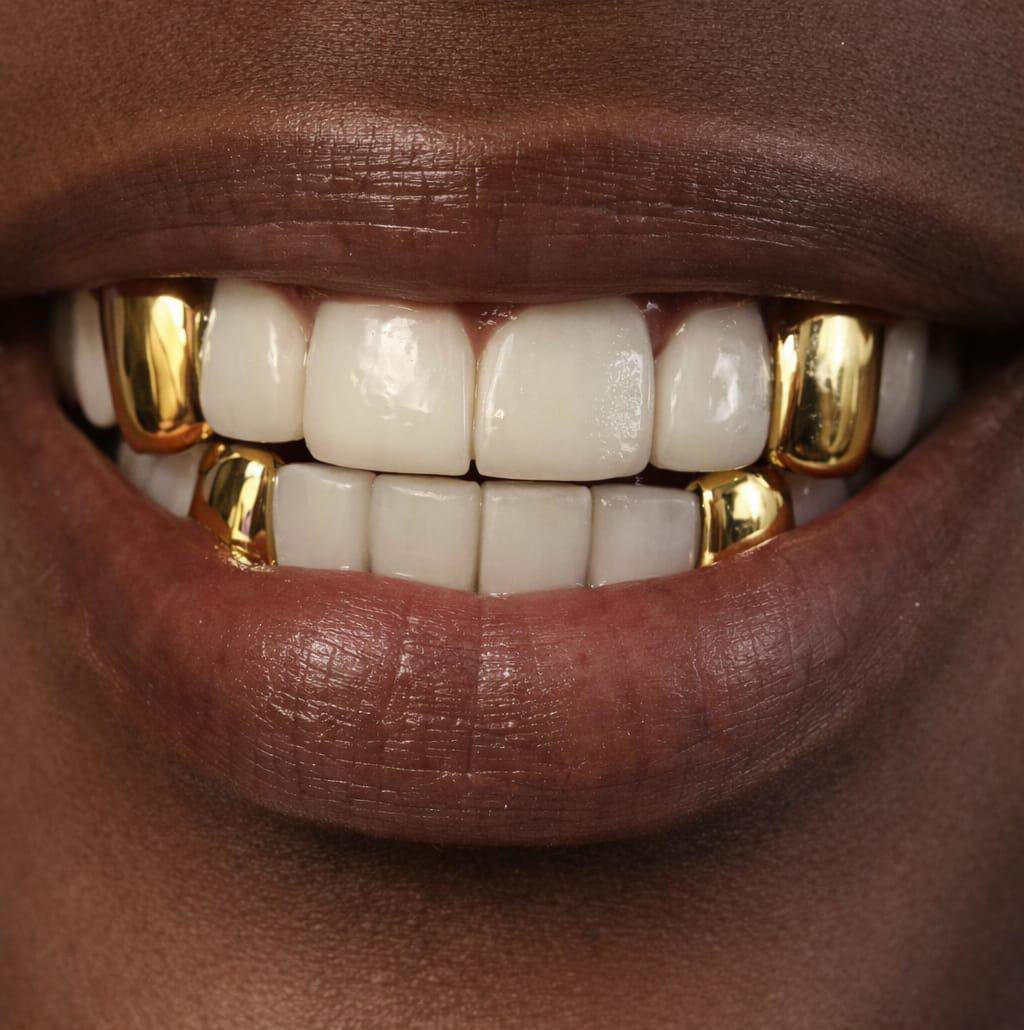 Diamond grillz