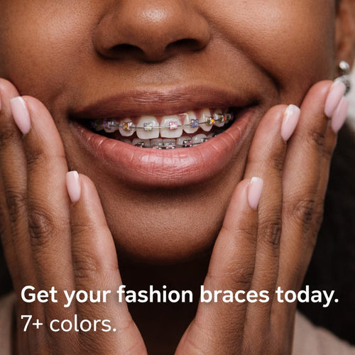 Braces without power chains